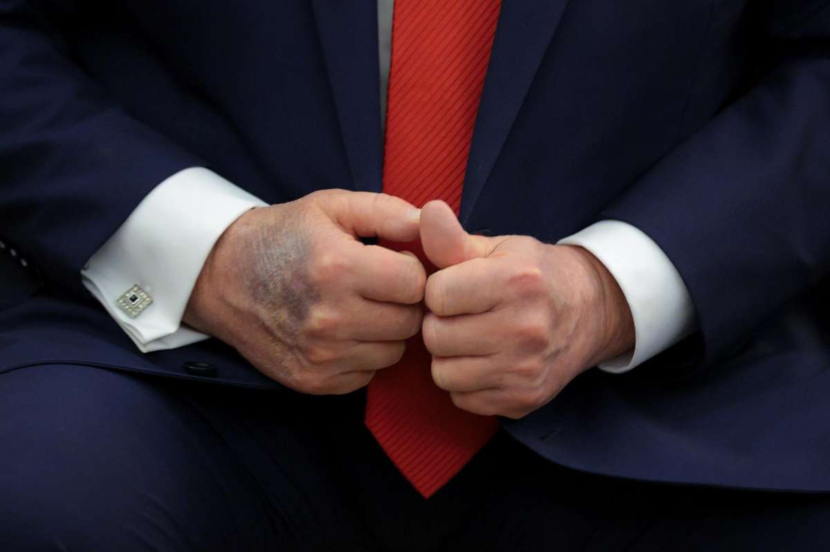 Moratón en una mano de Trump.