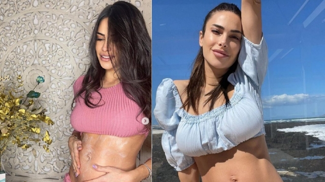 Carla Barber muestra la crema 'low cost' que usa contra las estrías durante el embarazo